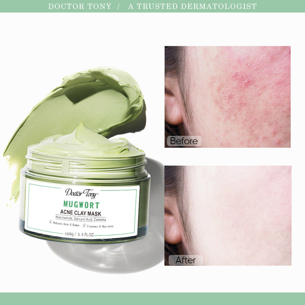 Anti-acne Argy Wormwood Clay Mask